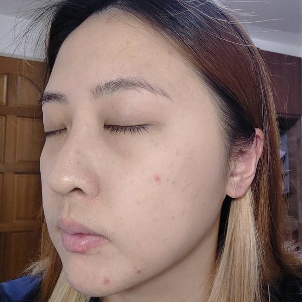 【ZYROL美姬水光錠】吃的醫美水光初體驗✨皮膚暗沉救星！讓